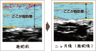 超音波結果